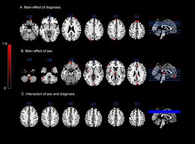 Sex differences of neural connectivity in internet gaming disorder and its association with sleep quality: an exploratory fMRI study